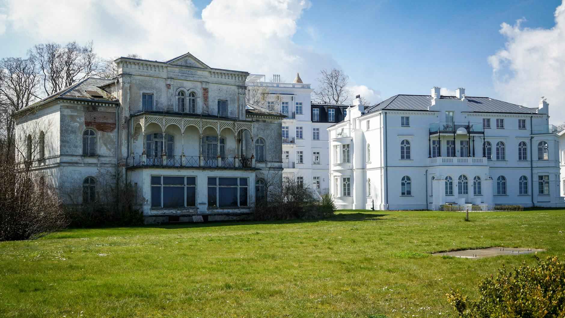 Peel And Stick Wall Decor: Easy Transformations Await 4 Best Places to Use It